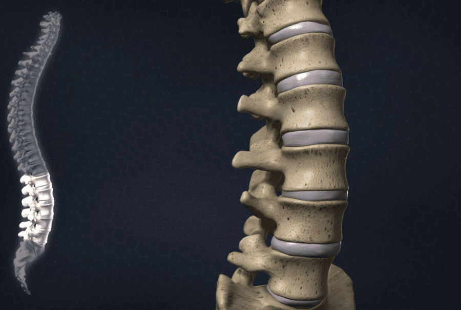 Spine image